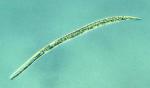 Root-Knot Nematode, Second Stage Juvenile